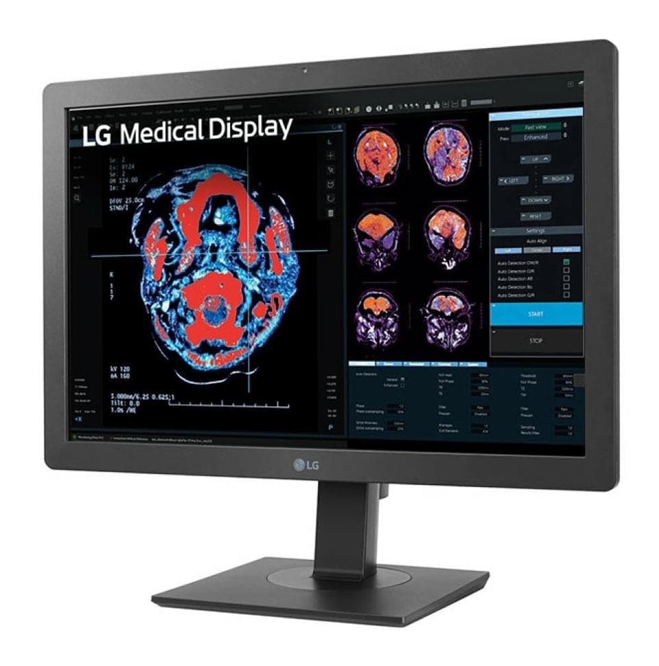 Monitor LG 24" 24HR513C-B.AEU - 2